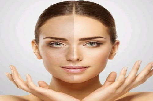 ../assets/images/global/microneedling.jpeg